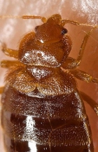 canadianvoices-bedbug