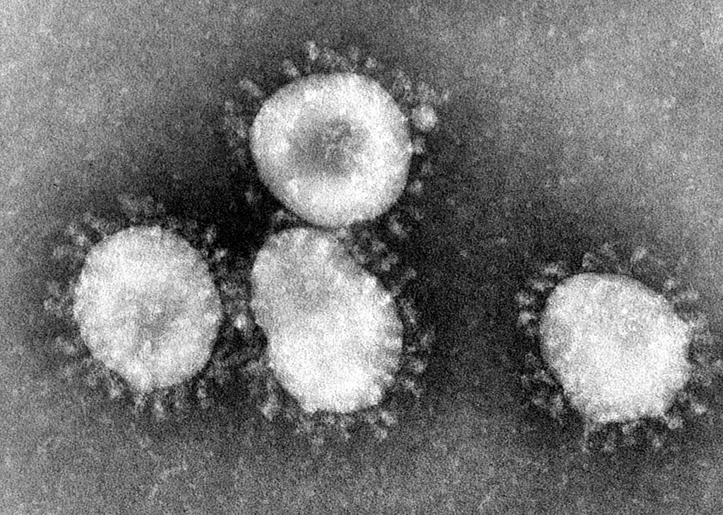 Coronavirus inside air passenger excited about Doug Ford's cuts to public health